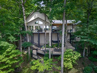 4 Ligadura Ln