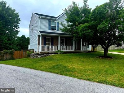 191 Fissure Ct